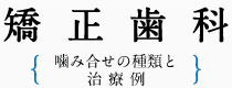 矯正歯科 - 噛み合わせの種類と治療例 - 