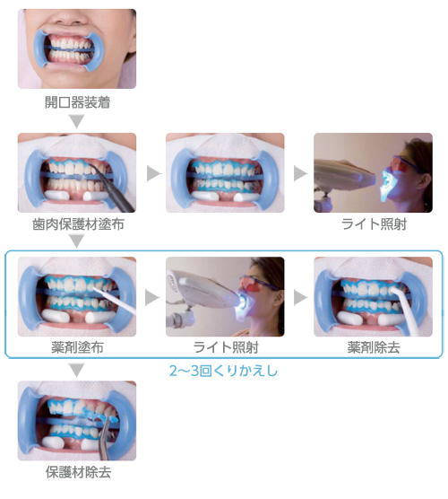 施術の流れフロー