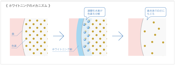 ホワイトニングのメカニズム概要図