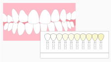 歯の色合い確認