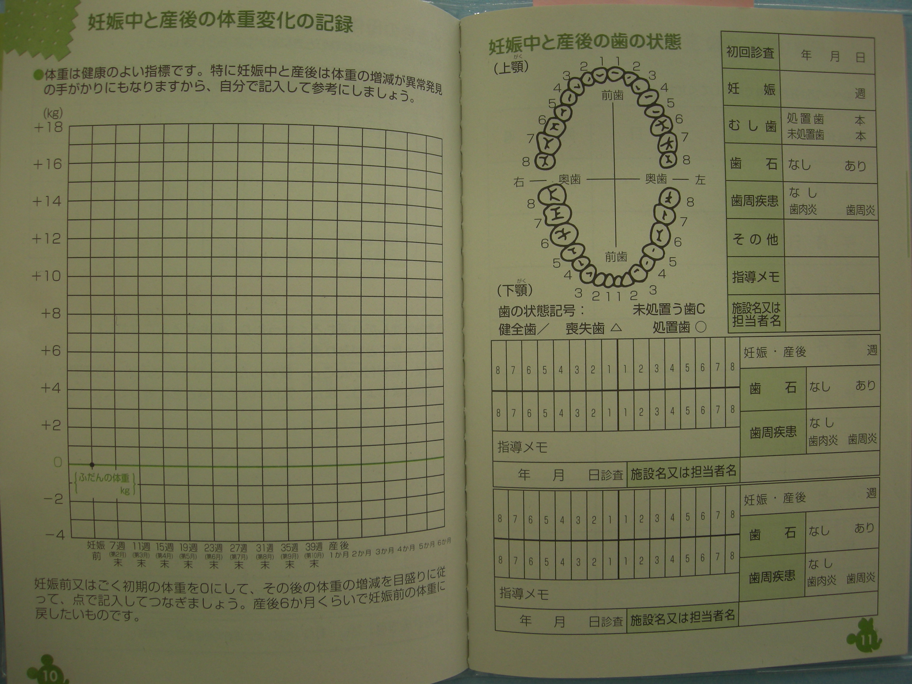 検診 妊婦 歯科